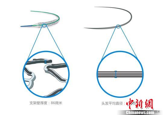 火鷹支架壁的凹槽與頭發(fā)直徑對(duì)比圖?！」﹫D 攝