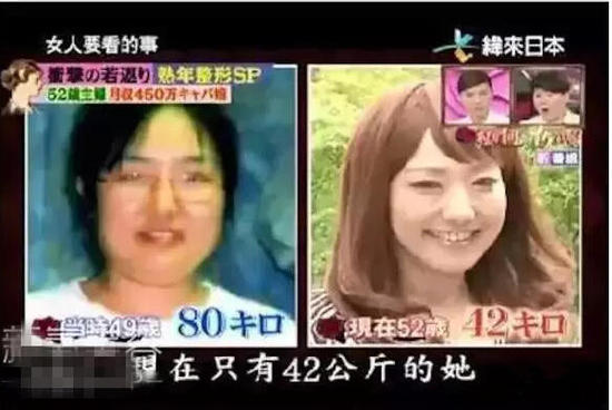 52歲大媽花450萬整成少女 為做小姐動(dòng)刀20次(圖)